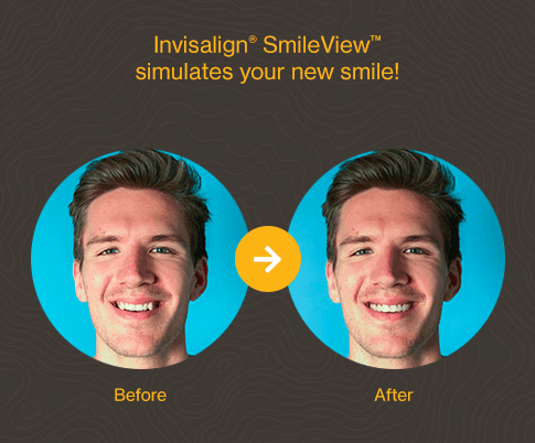 The SmileView App, Ferris Lane Dental